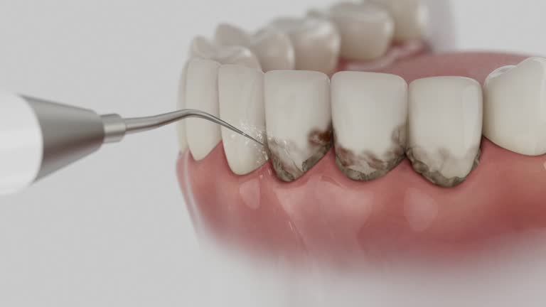Reliable Tooth Extraction contractor in Minnetonka, MN by Smile Center Dentistry